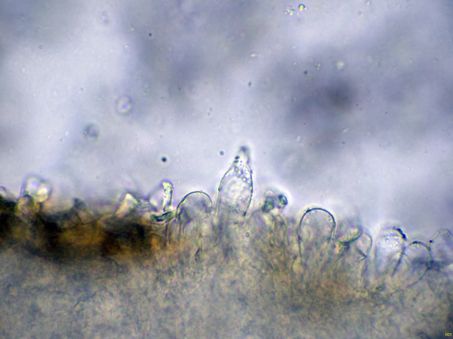 Microscopía de Psathyrella impexa - 10 - Queilocistidio agua-001